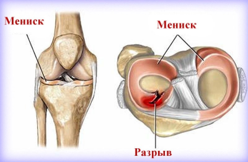 Help for foot surgery