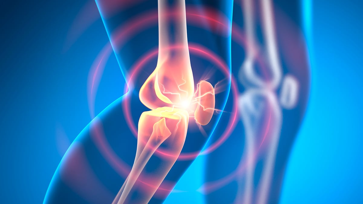 Experimental Drug Can Reverse Osteoarthritis in Weeks, Animal Research Shows - ScienceAlert
